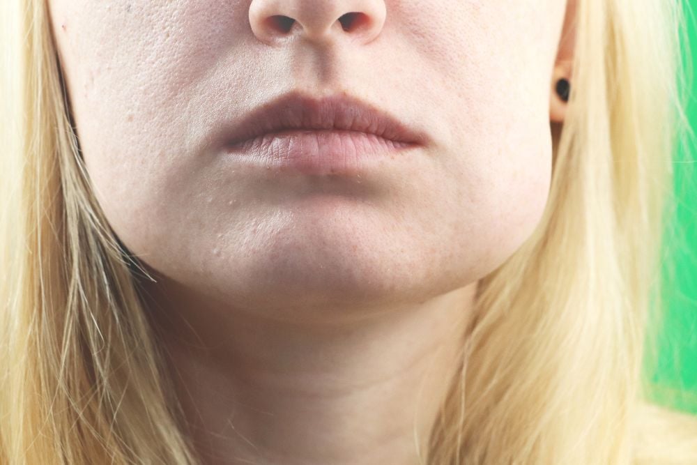 Cara hinchada después de un implante dental | Ester Rodríguez Clinica Dental en Salamanca