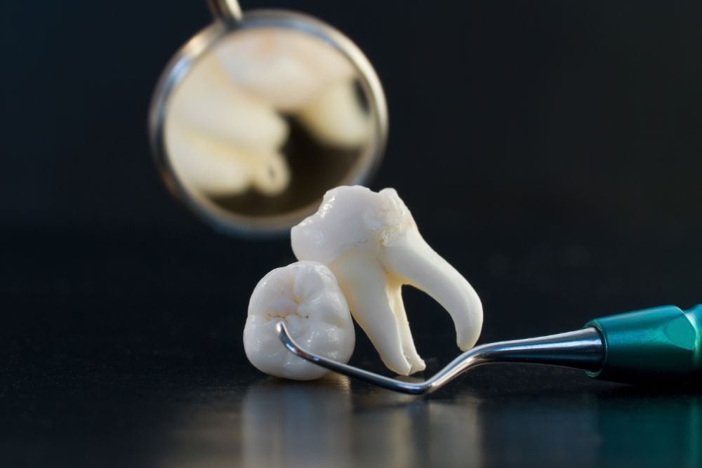 Me han sacado una muela y no para de sangrar | Ester Rodríguez Clínica Dental en Salamanca