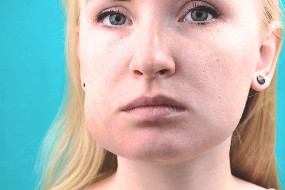¿Qué es la piorrea y cómo se cura? / Ester Rodriguez Clínica Dental