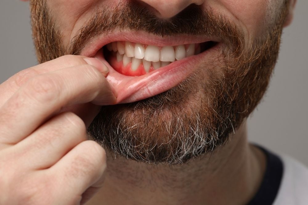 Tratamiento de encías: cómo cuidar y recuperar la salud de tus encías / Ester Rodríguez Clínica Dental