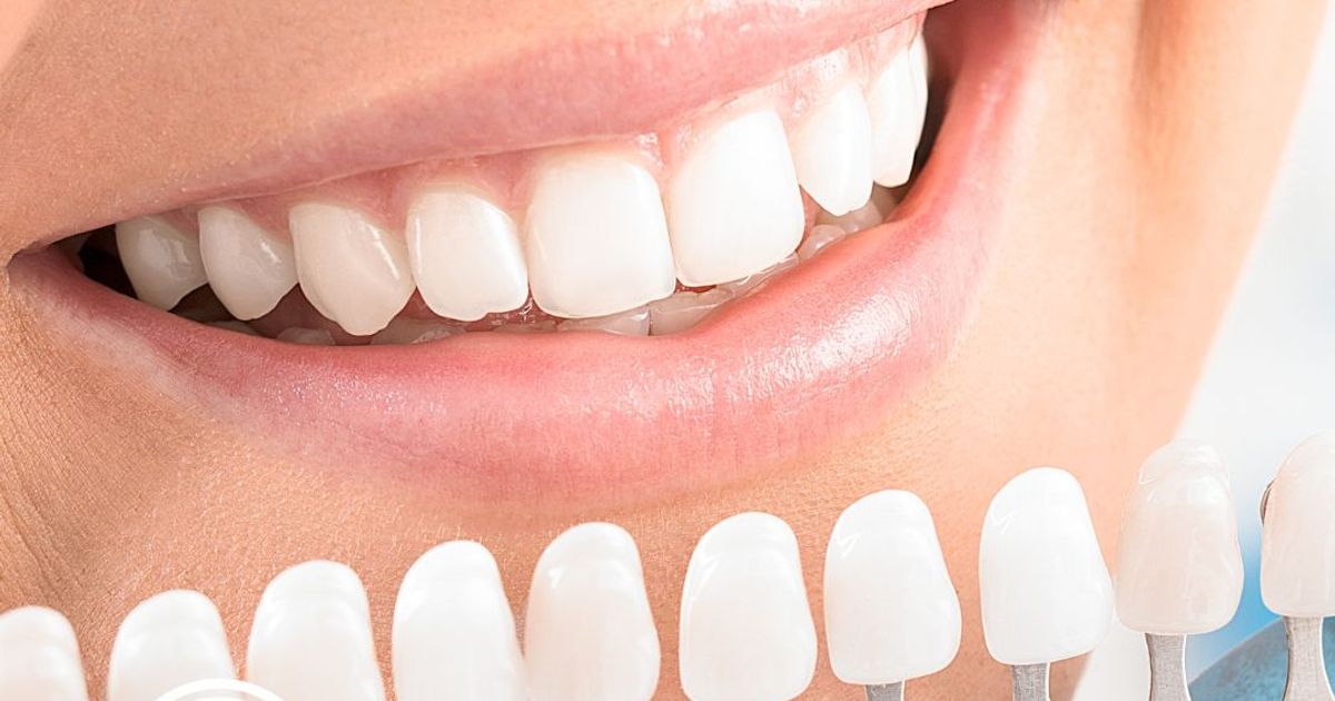 Estética Dental | Ester Rodríguez Clínica Dental | Ester Rodríguez