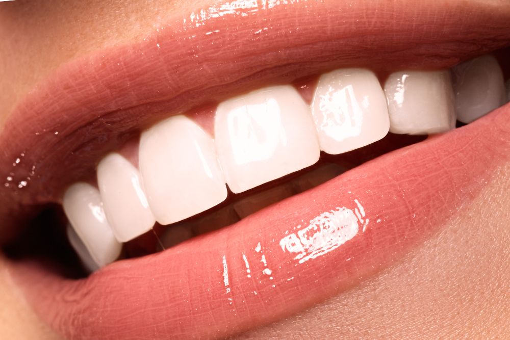 ¿Qué son las tinciones dentales y cómo tratarlas?