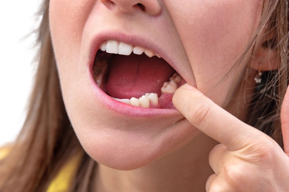 Dolor por muela picada: qué lo causa y cómo tratarlo / Ester Rodriguez Clínica Dental